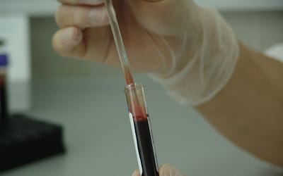 Диагностика рака с помощью анализов крови?